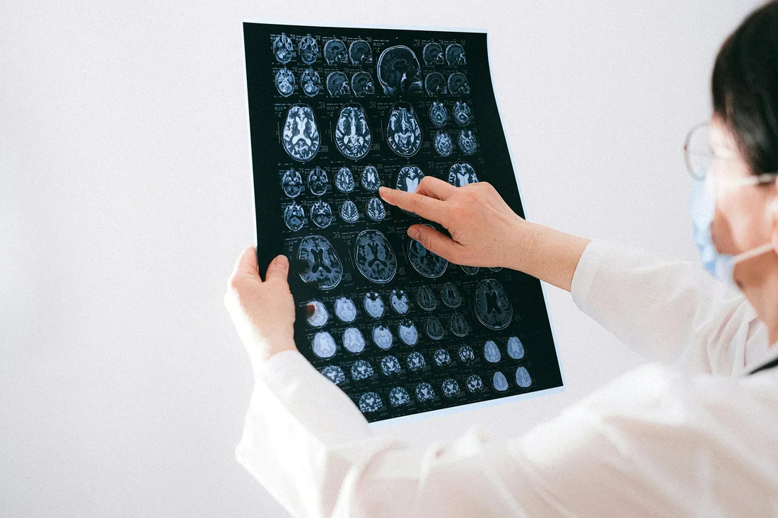 Early signs that your brain is failing you